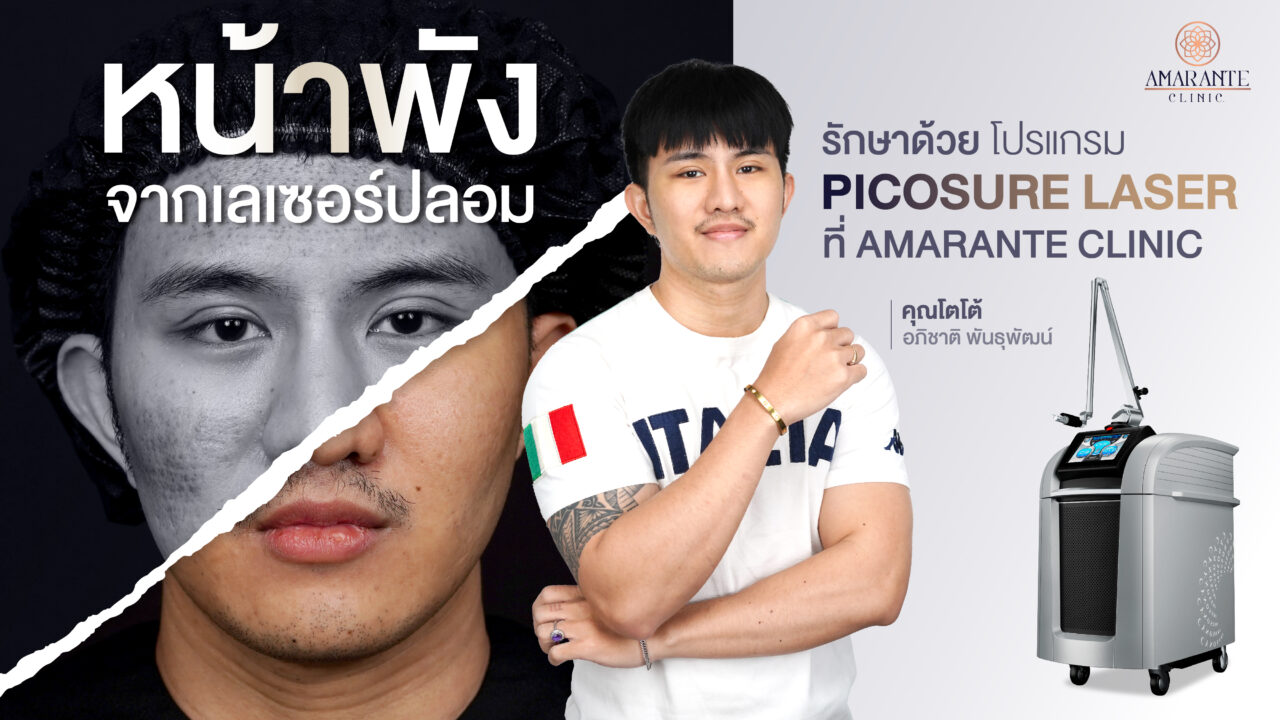 ปกภาพของบทความรีวิว Pico Laser ช่วยเหลือคุณโตโต้ หน้าพังจากเลเซอร์ปลอม
