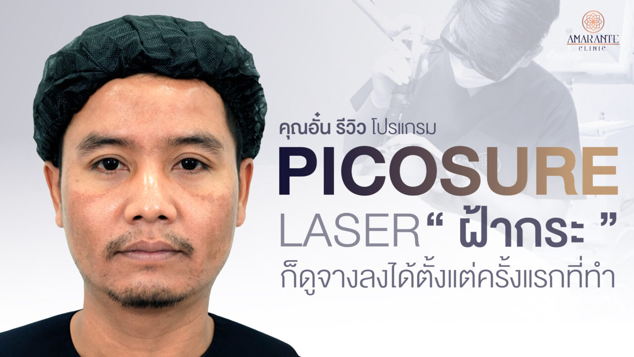 ปกภาพรีวิว pico laser คุณอั๋น