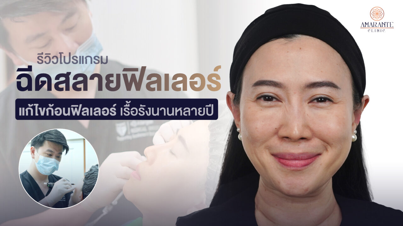 ปกภาพเคสรีวิว ฉีดสลาย filler ใต้ตา คุณแนน แก้ไขก้อนฟิลเลอร์ เรื้อรังนานหลายปี