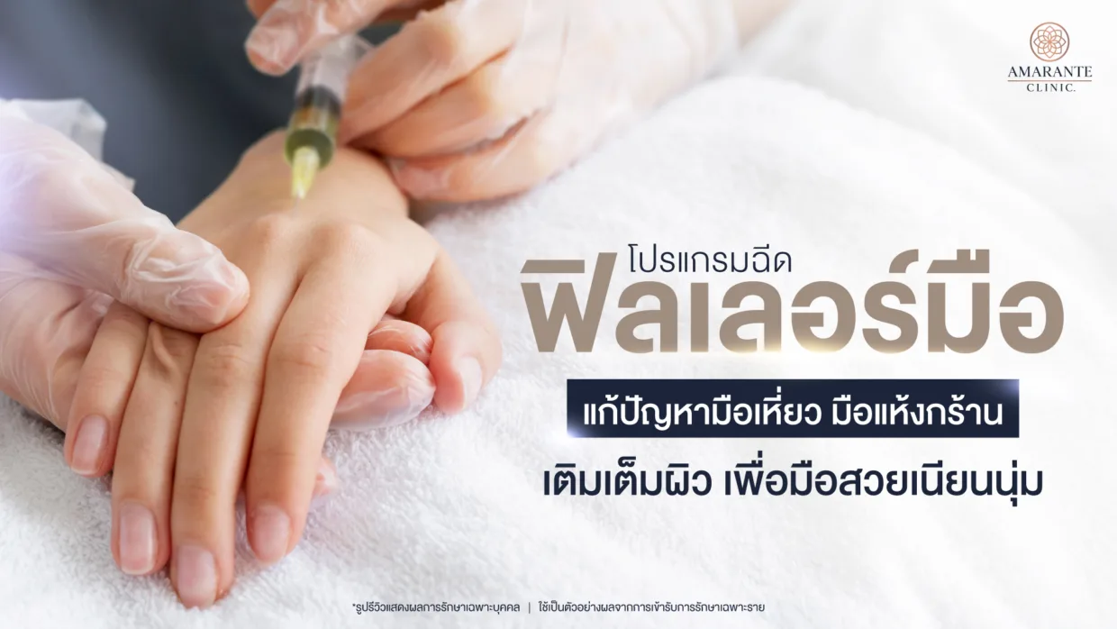 ฉีดฟิลเลอร์มือ