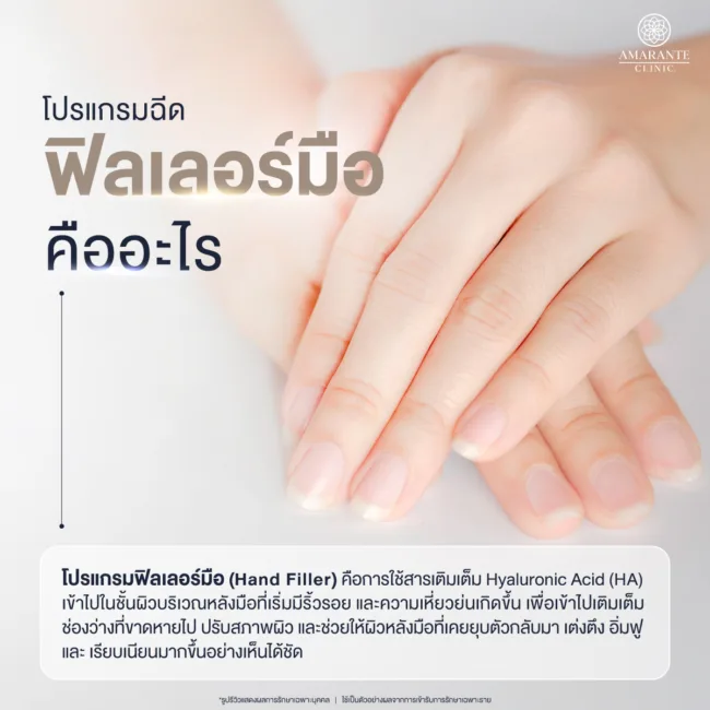 ฟิลเลอร์มือ คืออะไร