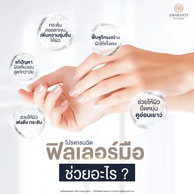 ฉีดฟิลเลอร์มือ ช่วยอะไร