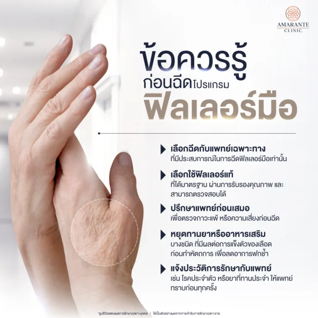 ข้อควรรู้ก่อนฉีดฟิลเลอร์มือ