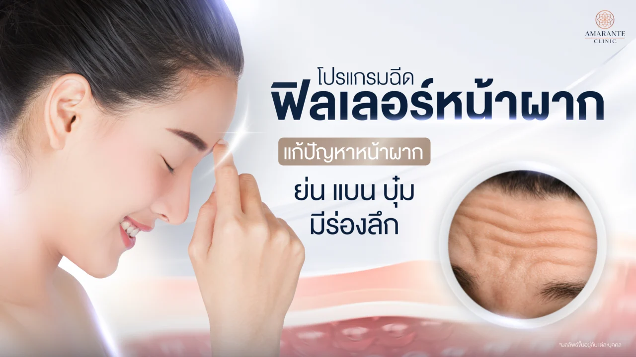 ฉีดฟิลเลอร์หน้าผาก