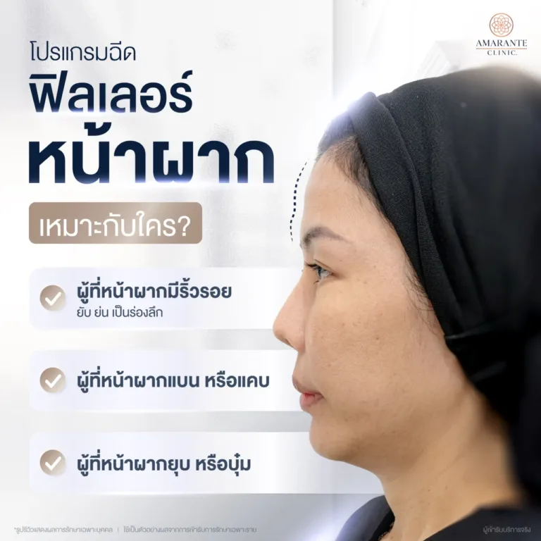 โปรแกรมฉีดฟิลเลอร์หน้าผากดีไหม เหมาะกับใคร ?