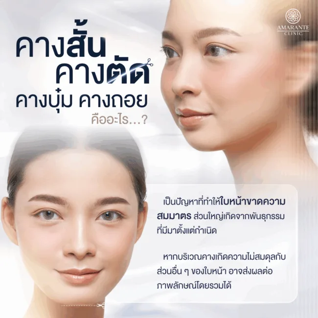 คางสั้น คางตัด คางบุ๋ม คางถอย คือ
