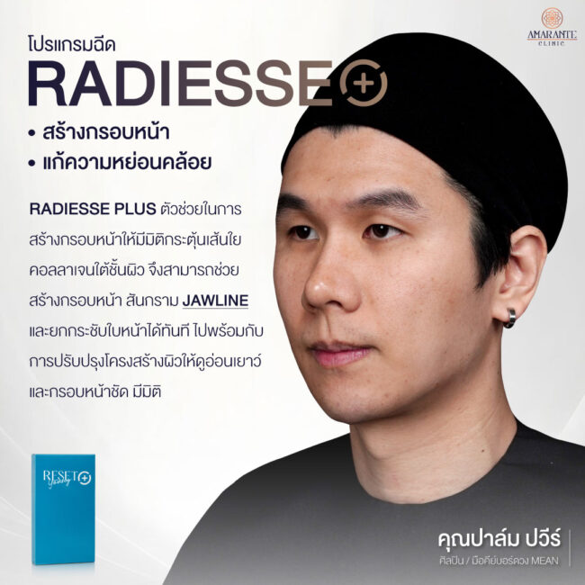 ภาพ infographic พูดถึงข้อดีของการฉีด Radiesse Plus โดยมีภาพคุณปาล์มเป็นพรีเซนเตอร์