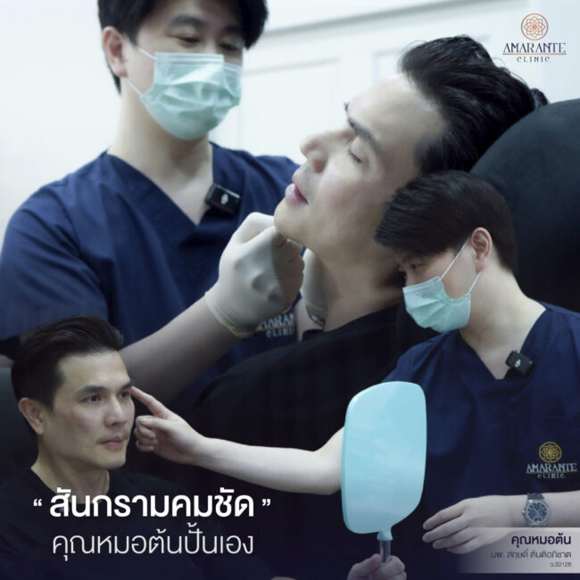 ภาพหน้าคุณแจ๊บที่มีปัญหา ใบหน้าหย่อน ขมับ แก้มตอบ กรอบหน้าไม่ชัด