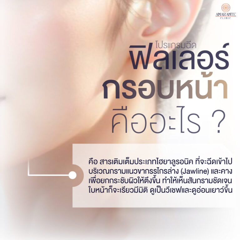 ฉีดฟิลเลอร์กรอบหน้า คืออะไร