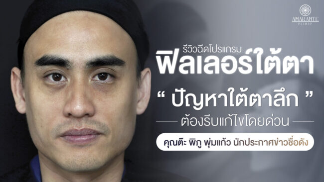 ปกภาพบทความรีวิว ฉีดฟิลเลอร์ใต้ตา ปัญหาใต้ตาลึก คุณต๊ะ พิภู