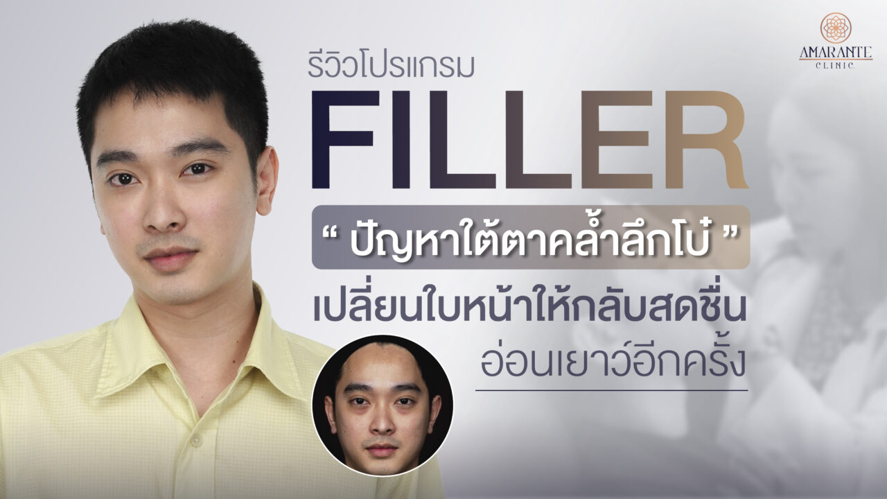 ปกภาพรีวิวฉีดฟิลเลอร์ คุณเจ แก้ไขปัญหาใต้ตาคล้ำลึกโบ๋ เปลี่ยนใบหน้าให้กลับสดชื่น อ่อนเยาว์อีกครั้ง