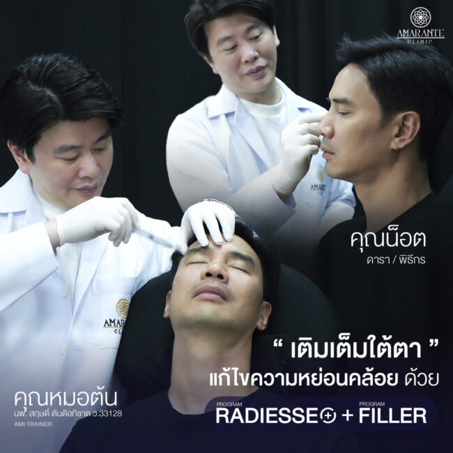 ภาพคุณหมอต้นกำลังทำการรักษาปัญหาผิวหน้าให้คุณน๊อตด้วยการฉีด Radiesse Plus กับฉีดฟิลเลอร์