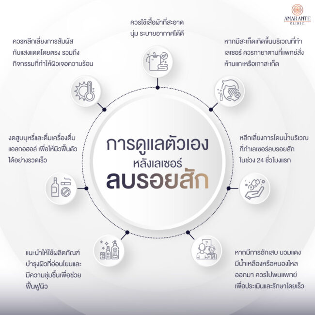 ภาพ infographic อธิบาย การดูแลตัวเองหลังเลเซอร์ลบรอยสัก