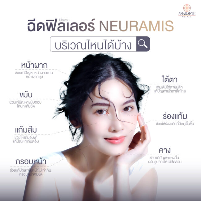 ภาพ infographic โชว์ให้เห็นจุดบริเวณไหนบนใบหน้าที่สามารถฉีดฟิลเลอร์ Neuramis ได้