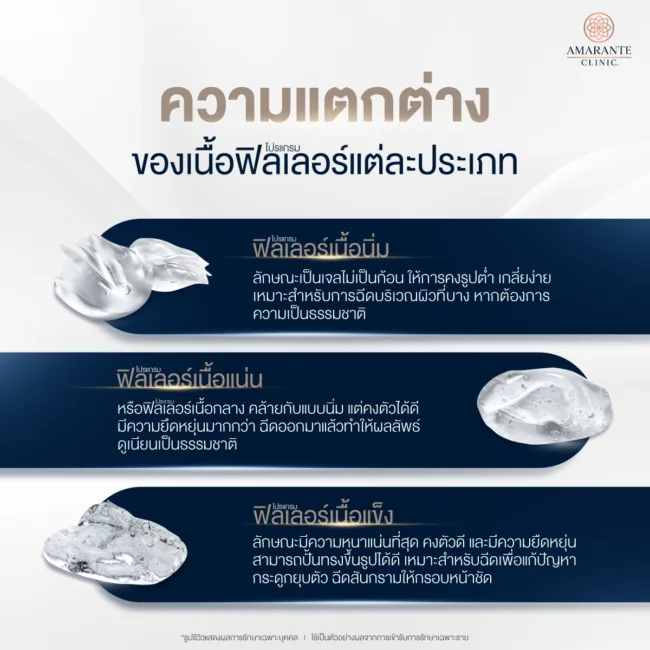 ความต่างของเนื้อฟิลเลอร์แต่ละประเภท