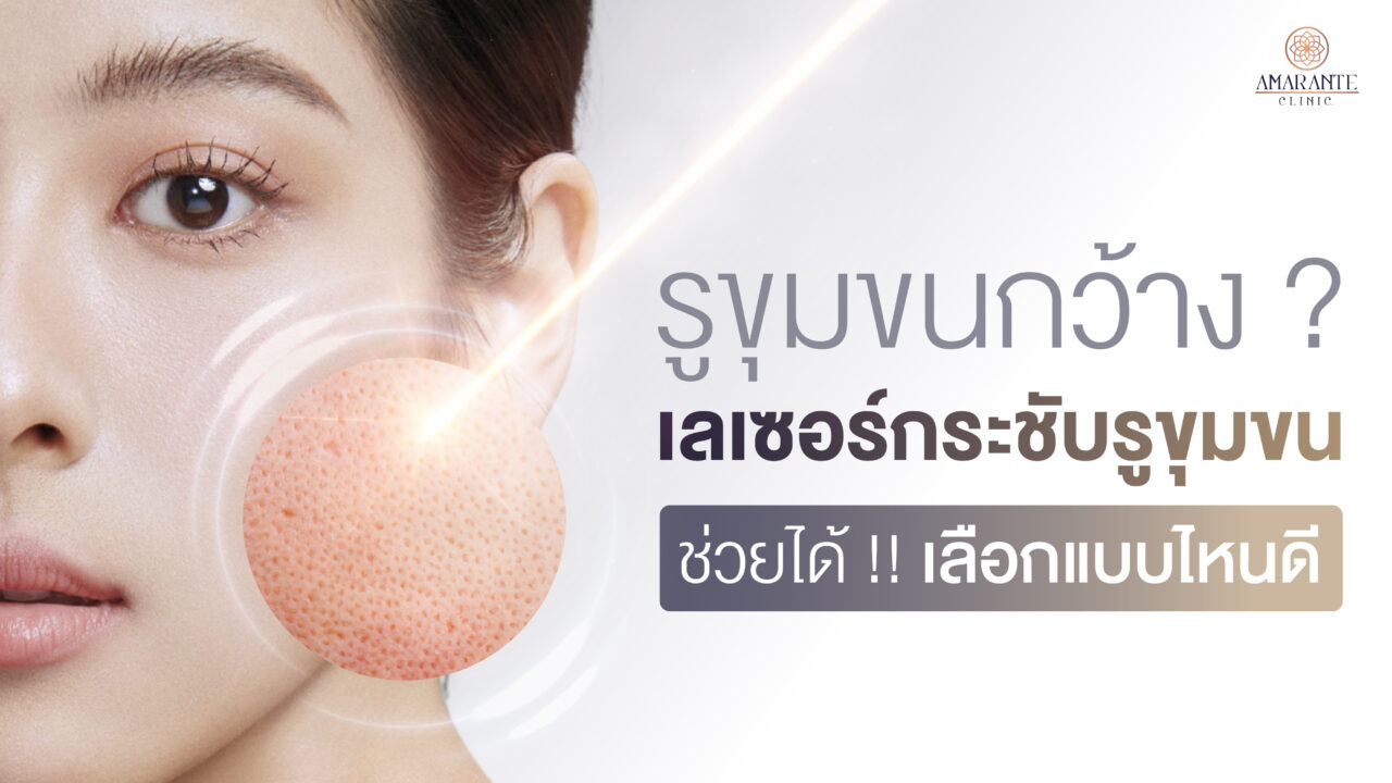 รูขุมขนกว้าง? เลเซอร์กระชับรูขุมขน ช่วยได้! เลือกแบบไหนดี