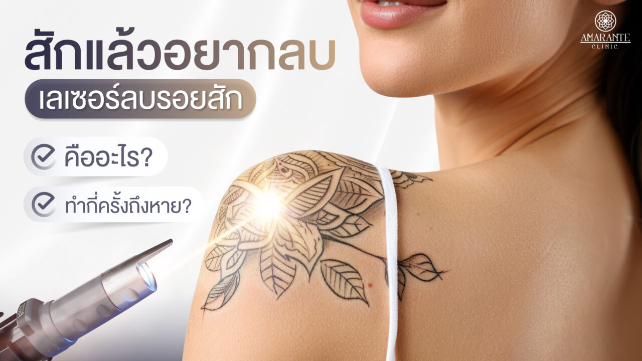 ปกภาพของบทความ - สักแล้วอยากลบ? "เลเซอร์ลบรอยสัก" คืออะไร ทำกี่ครั้งถึงหาย