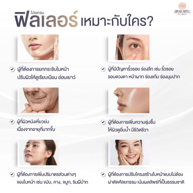 ภาพ infographic อธิบาย ฟิลเลอร์เหมาะกับใคร
