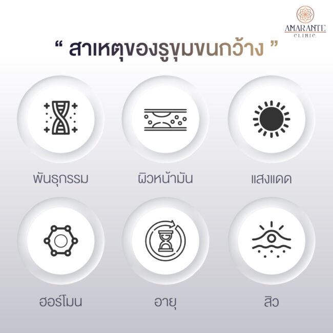 ภาพประกอบของหัวข้อ - สาเหตุของรูขุมขนกว้าง