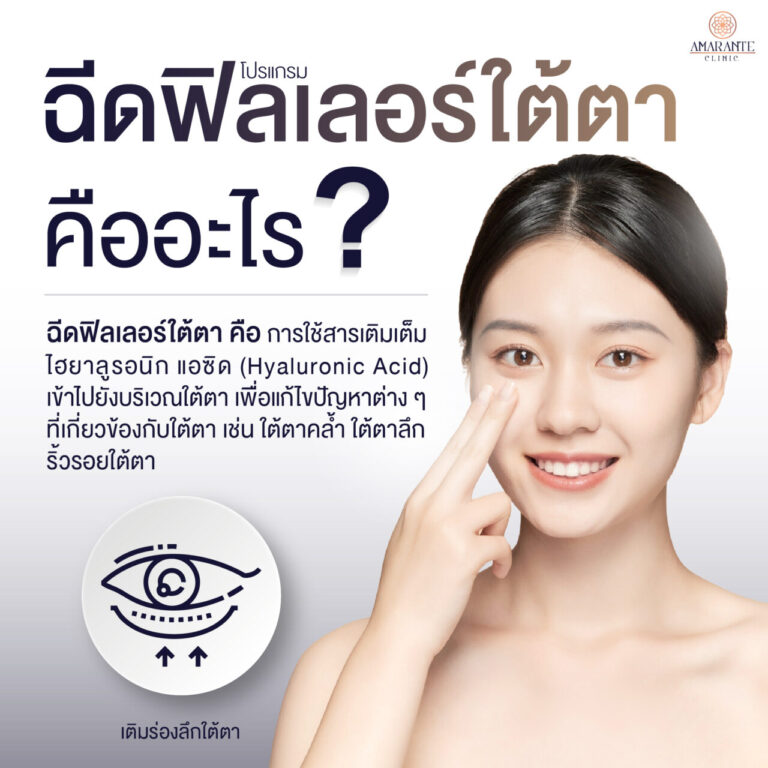 ฉีดฟิลเลอร์ใต้ตาคืออะไร?