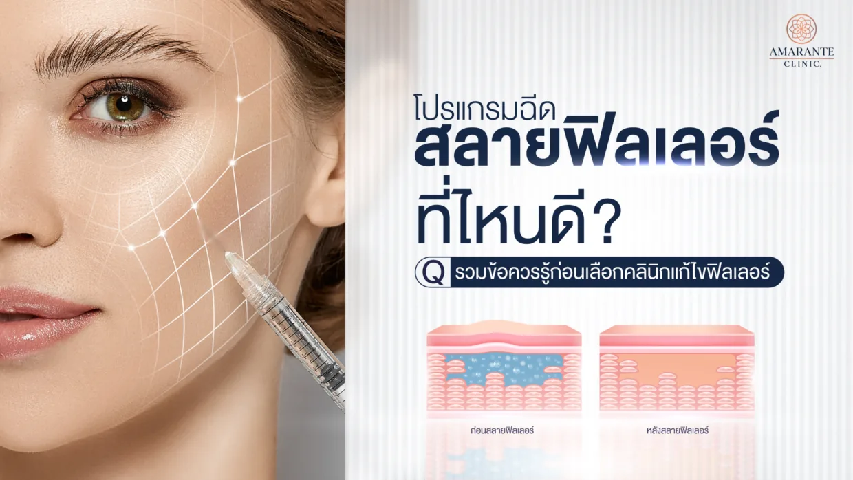 ฉีดสลายฟิลเลอร์ที่ไหนดี? ข้อควรรู้ก่อนเลือกคลินิกแก้ไขฟิลเลอร์