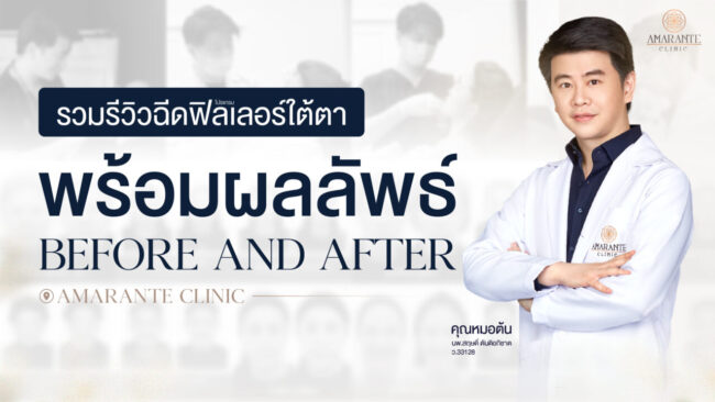 ปกภาพบทความ รวมรีวิวฉีดฟิลเลอร์ใต้ตาพร้อมภาพผลลัพธ์ Before and After ที่ Amarante Clinic