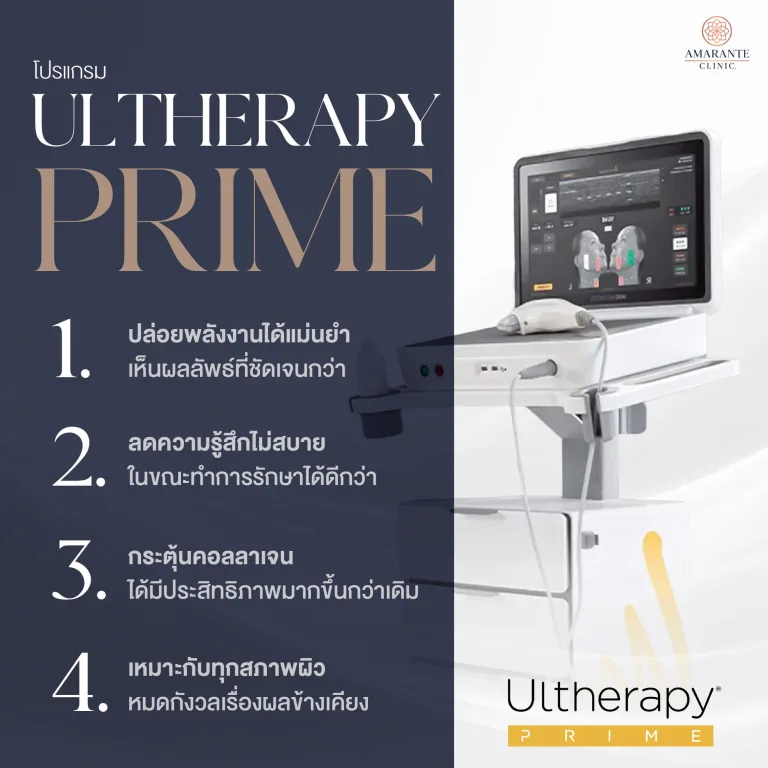 ภาพ infographic อธิบาย ข้อดีของ Ultherapy Prime ที่เหนือกว่า Ulthera SPT