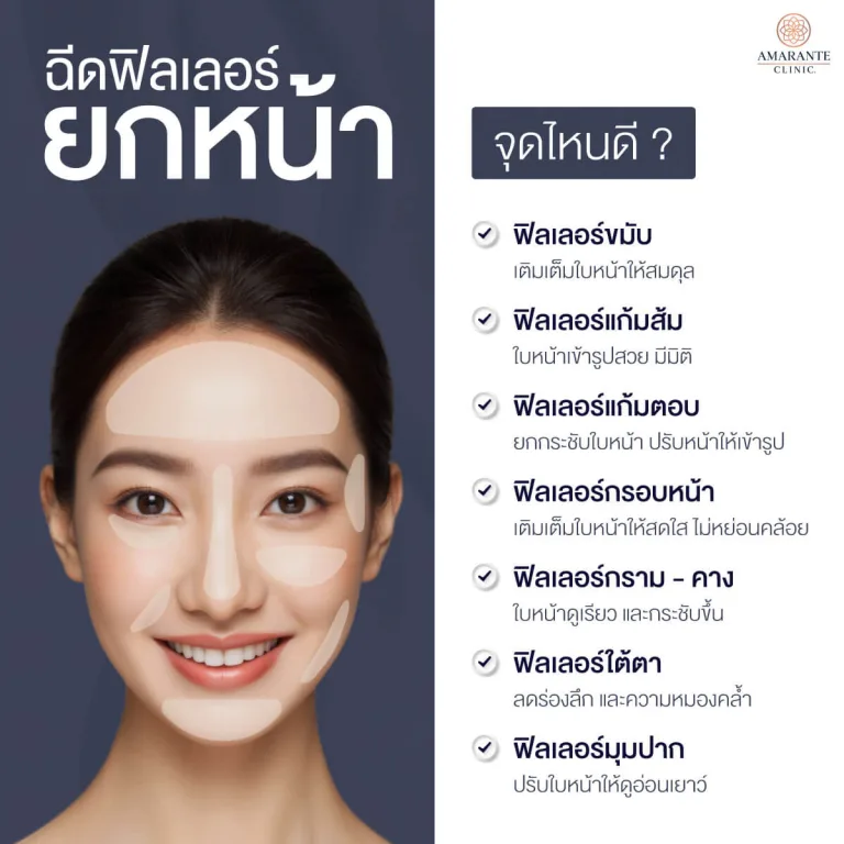 ฉีดฟิลเลอร์ยกกระชับหน้าจุดไหนได้บ้าง