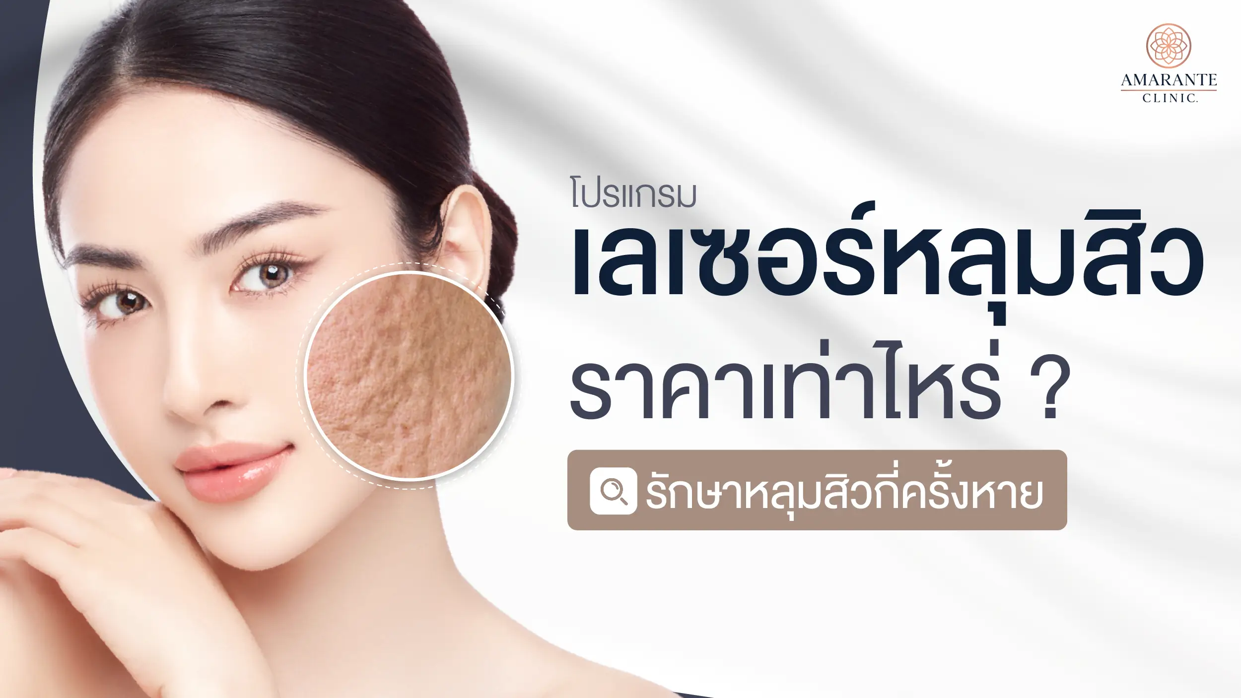 โปรแกรมเลเซอร์หลุมสิว