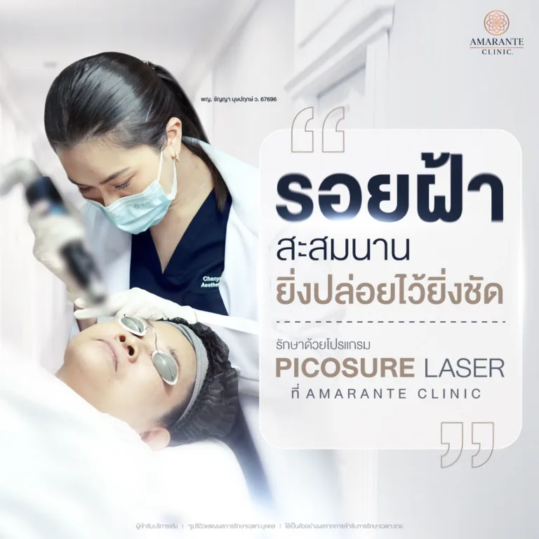 รักษาฝ้า ด้วย Picosure Pro