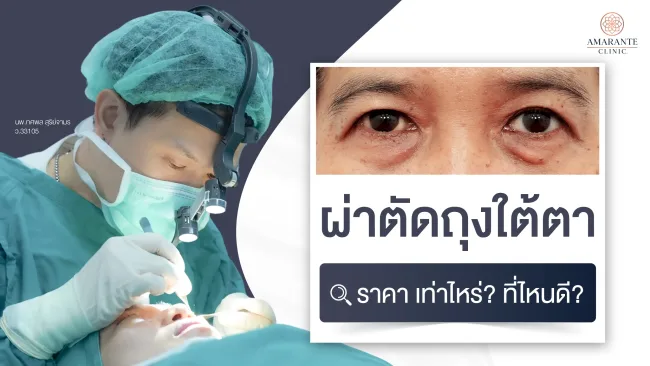 ผ่าตัดถุงใต้ตา-ราคา-เท่าไหร่-ที่ไหนดี