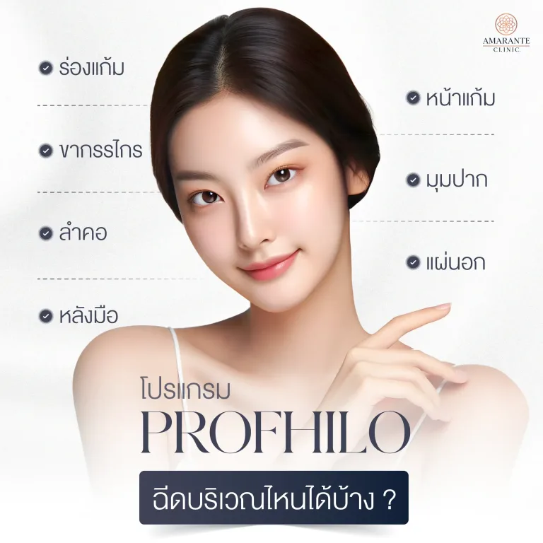 Profhilo ฉีดบริเวณไหนได้บ้าง