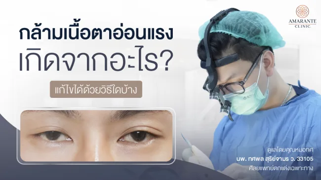 ปกภาพบทความ กล้ามเนื้อตาอ่อนแรง เกิดจากอะไร มีวิธีการรักษาแบบไหนบ้าง