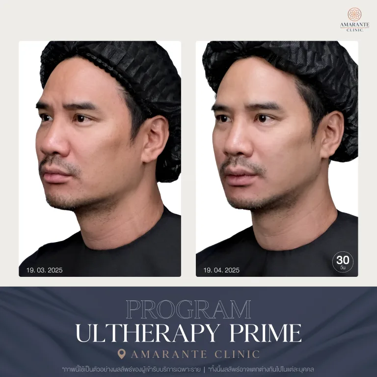 รีวิว Uthera Prime คุณน๊อต