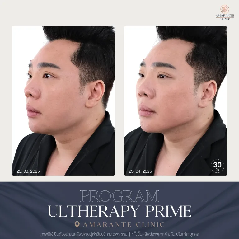 รีวิว Uthera Prime คุณมดดำ