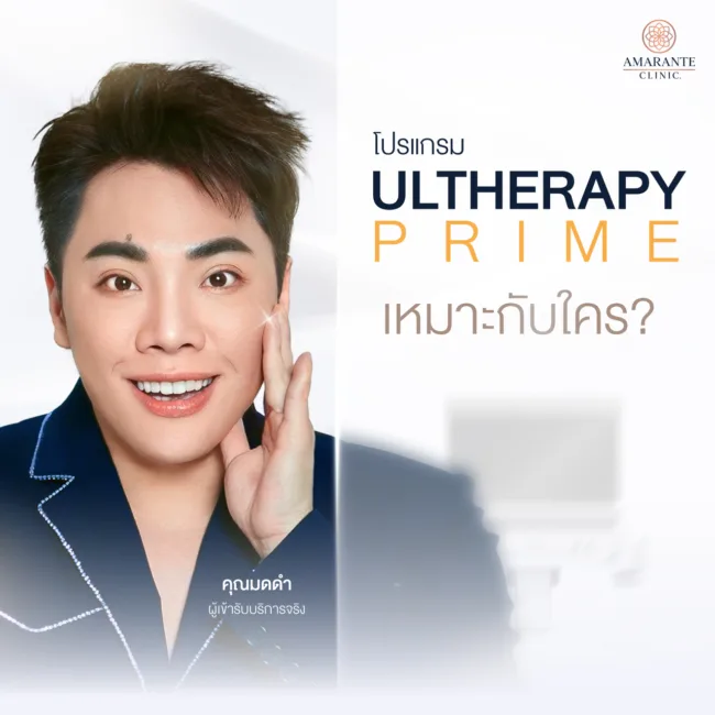 Ultherapy Prime ดีอย่างไร