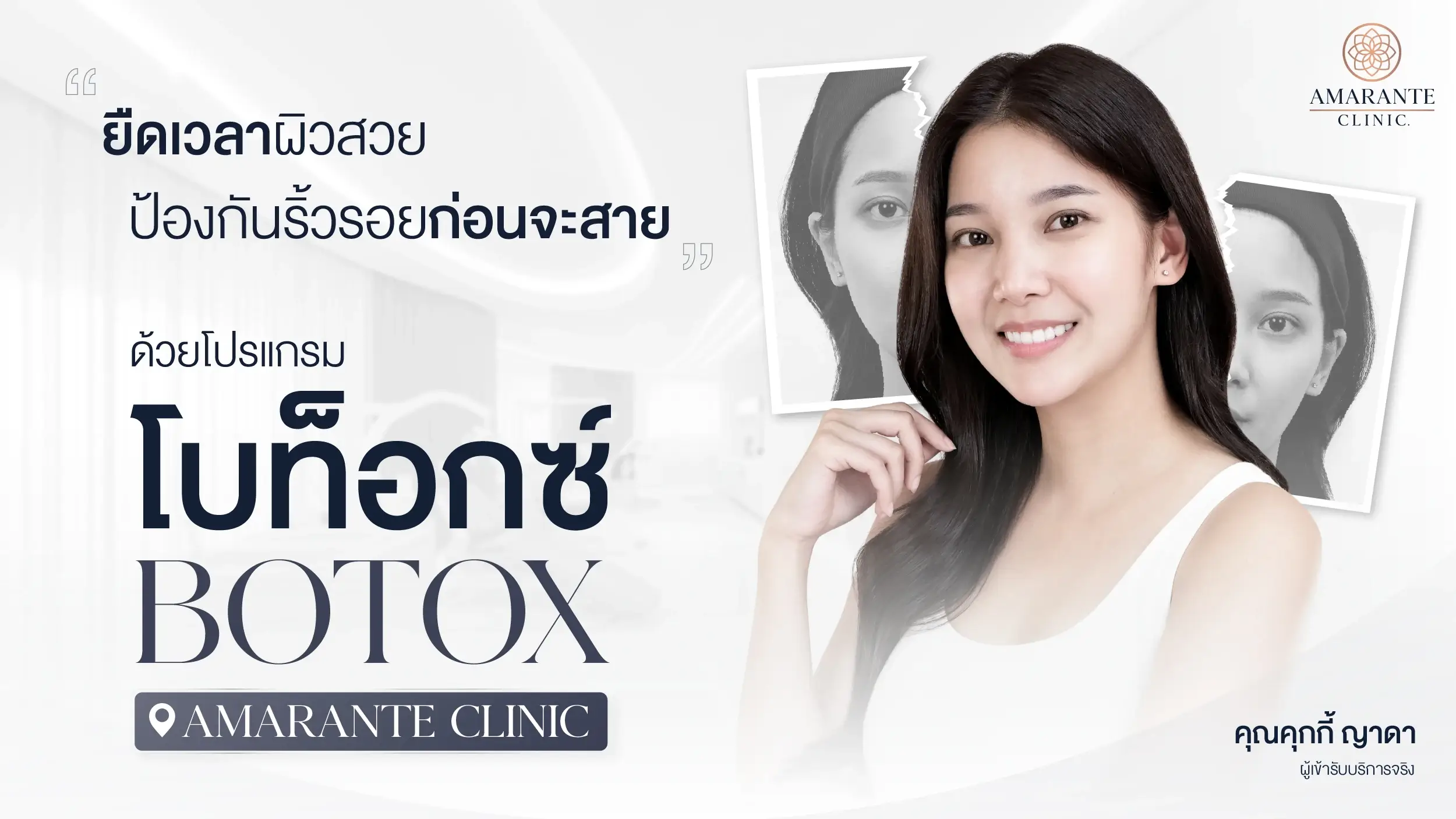 ฉีดโบท็อก (Botox) ป้องกันริ้วรอย