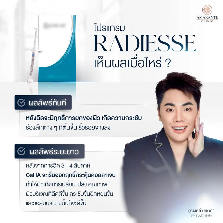 Radiesse เห็นผลเมื่อไหร่?