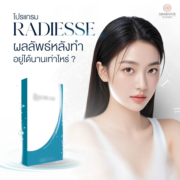 Radiesse ผลลัพธ์อยู่ได้นานเท่าไหร่