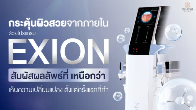 กระตุ้นฟิลเลอร์ด้วย Exion