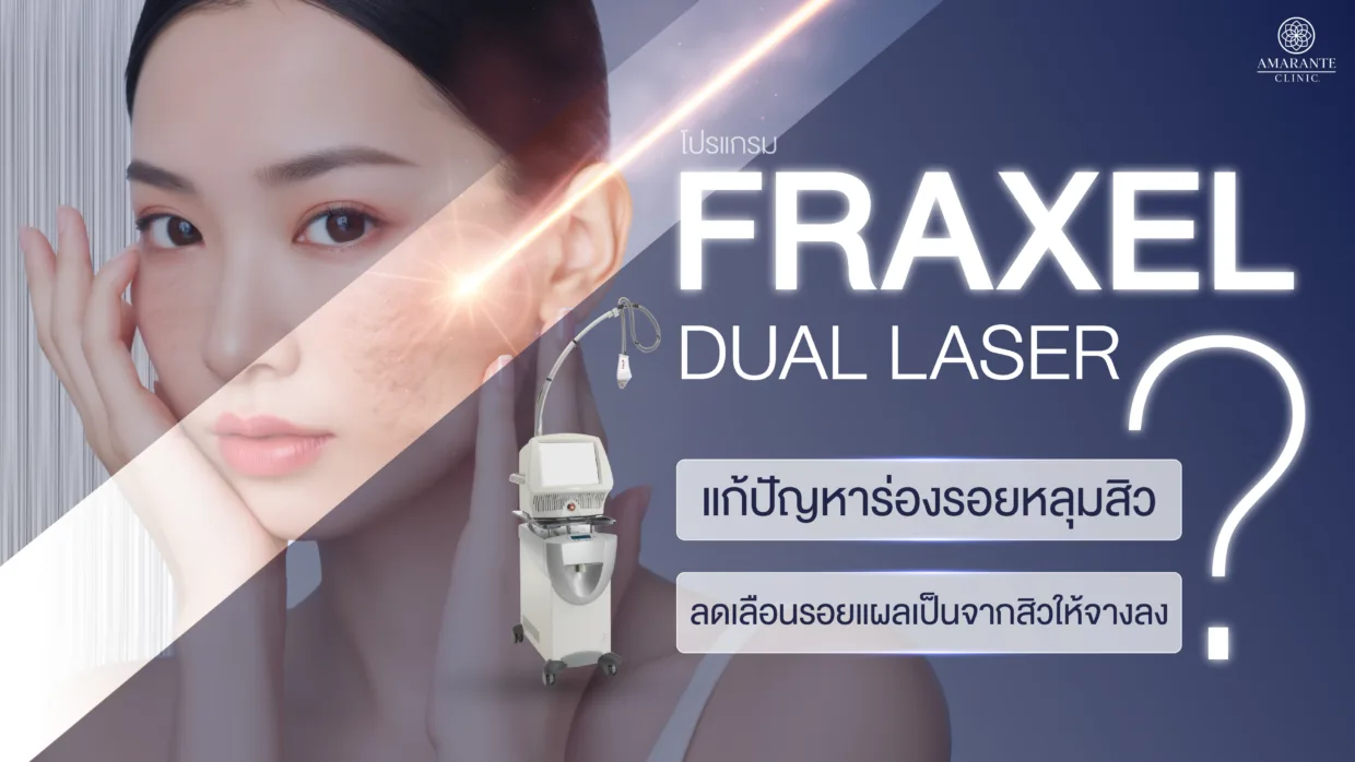 Fraxel Dual Laser เทคโนโลยีแก้ปัญหาร่องรอยหลุมสิว