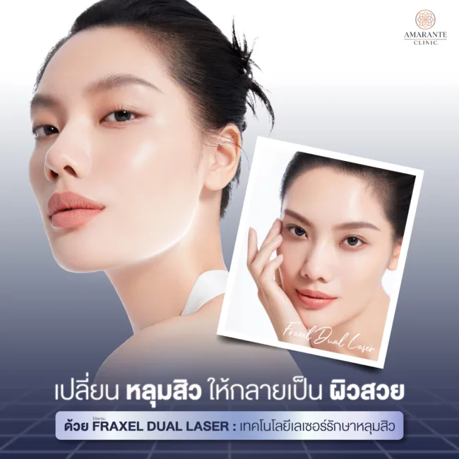 โปรแกรมรักษา หลุมสิว ผิวไม่เรียบเนียน รูขุมขนกว้าง ด้วย Fraxel Dual Laser ที่ Amarante Clinic ดีอย่างไร ดีอย่างไร