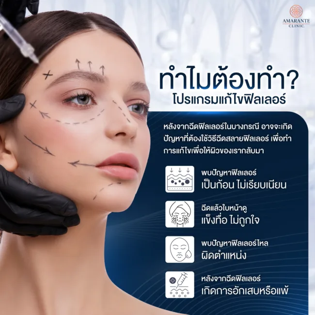 ทำไมต้องสลายฟิลเลอร์