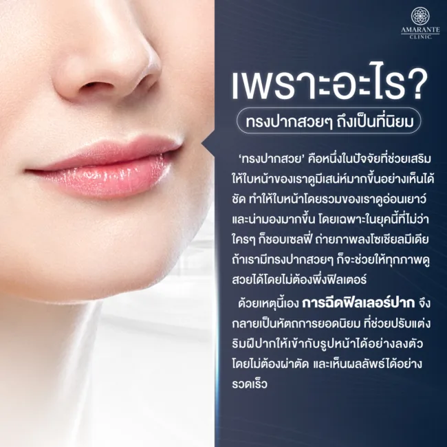 ที่มาของความนิยมของทรงปาก