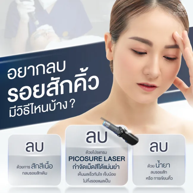 อยากลบรอยสักคิ้ว มีวิธีอย่างไรบ้าง