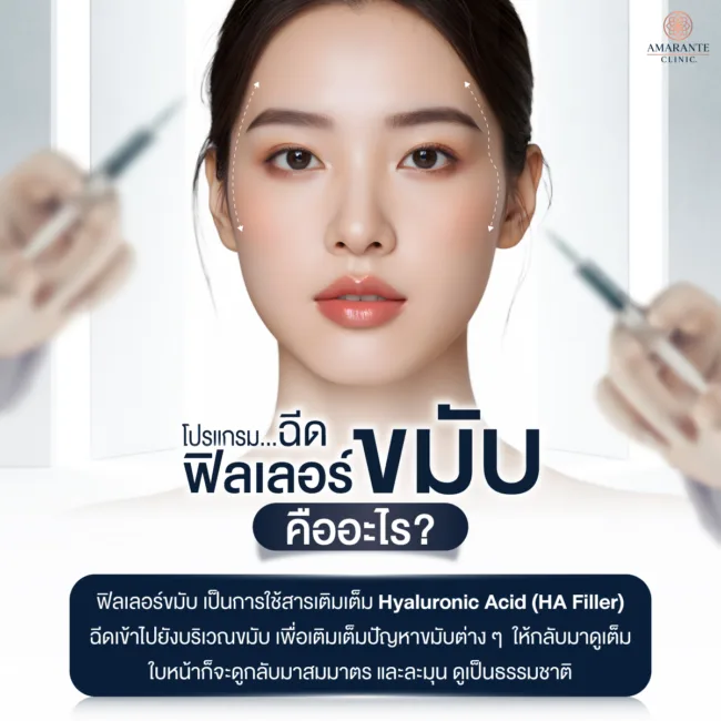 ฉีดฟิลเลอร์ขมับ คืออะไร