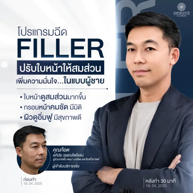 โปรแกรมฟิลเลอร์ยกหน้าเทคนิค A³ Lifting เทคนิคเฉพาะของคุณหมอต้นที่ Amarante Clinic