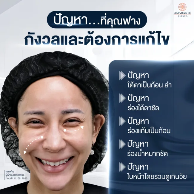 ปัญหากล้ามเนื้อใต้ตาเป็นก้อนของคุณฟาง