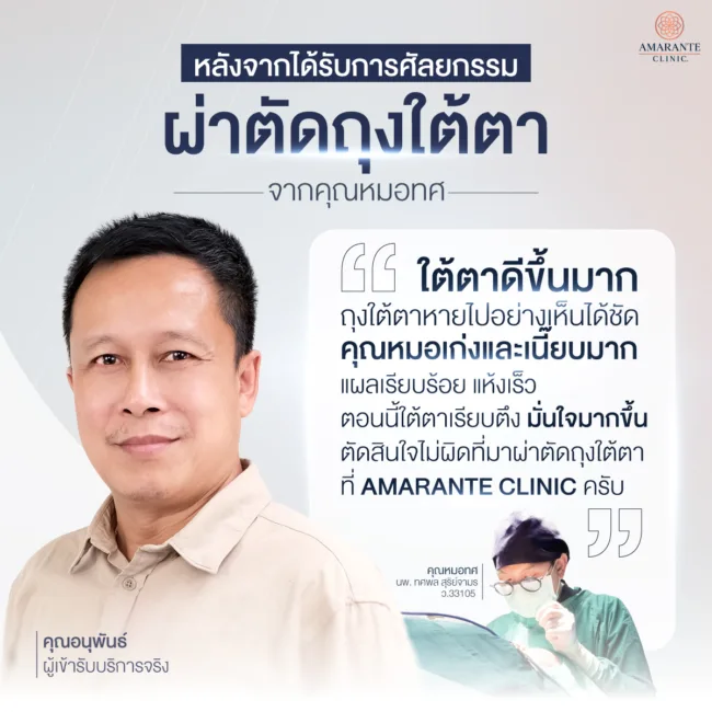 คุณหมอทศพลแก้ไขปัญหาถุงใต้ตาเป็นก้อนให้กับคุณอนุพันธ์