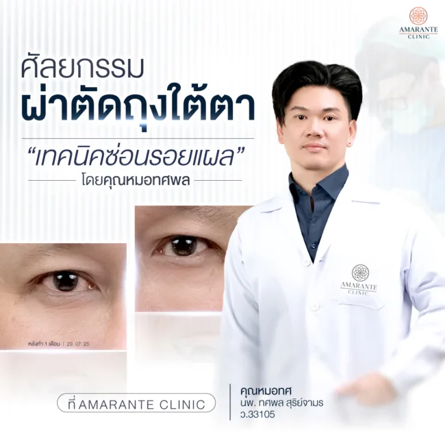 ศัลยกรรมผ่าตัดถุงใต้ตาเทคนิคซ่อนรอยแผลโดยคุณหมอทศพลที่ Amarante Clinic